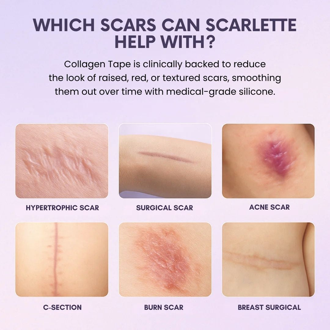 Silicone Collagen Sheets Buy 1 Get 1 Free