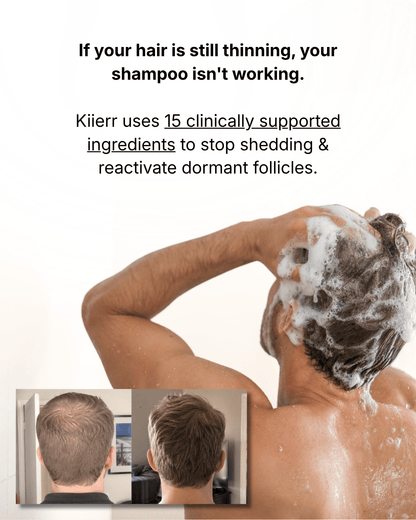 15-in-1 Daily DHT Blocking  Follicle Revival™ Shampoo
