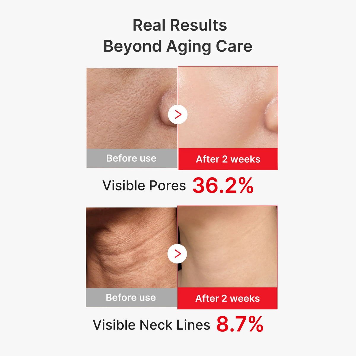 Skin Firming Serum | BUY 1 GET 1 FREE